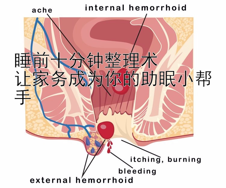 睡前十分钟整理术  加拿大28回水什么意思  让家务成为你的助眠小帮手